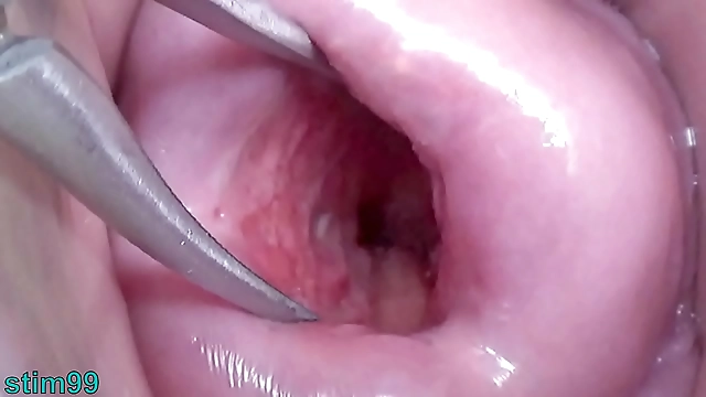 Japanese Wife Blesses Your Eyes with her Wide Open Cervix as you Witness the Beauty of her Uterus
