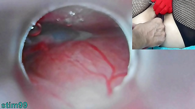 Japanese Insemination: Cum in Uterus Endoscope Camera in Cervix Uncensored Womb View