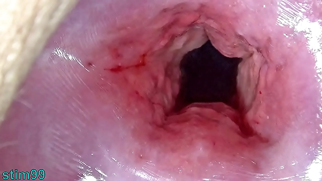 Japanese Beauty s Luscious Cervix Stretched to the Max with Intense Dilation and Penetration